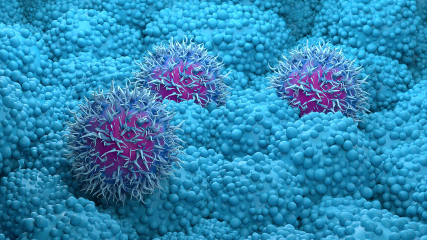 RevMed's Pancreatic Cancer Drug Doubles Survival Time in Phase 3 Trial 1 108290357 1776080530841 gettyimages 1836051960 f0402950