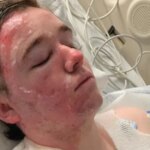 260608 jacob smith oil burns mn 1135 4186ac