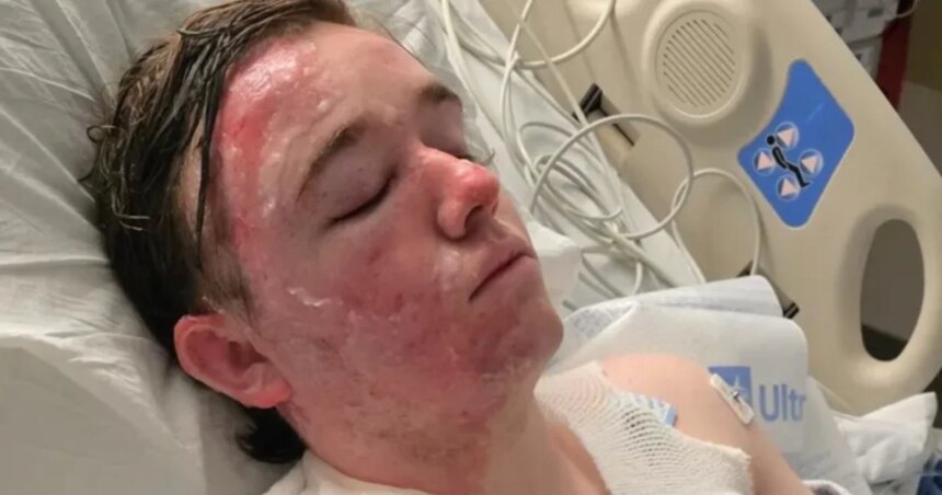 260608 jacob smith oil burns mn 1135 4186ac